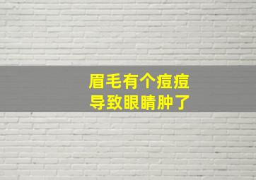 眉毛有个痘痘 导致眼睛肿了